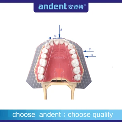 치아의 투명 가이드 플레이트